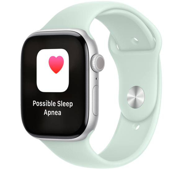 Apple Watch Series 10 - Image 2